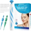 14Pcs Left🔥 | Bikenda® Auto-Micro Skin Tag Remover Kit