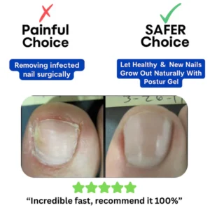 Maanufo Fungal Nail Renewal Patches