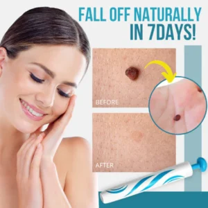 14Pcs Left🔥 | Bikenda® Auto-Micro Skin Tag Remover Kit