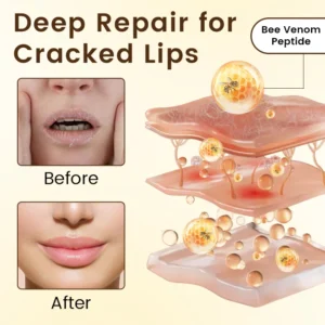 Ceoerty® BeeLixir Lip Repair Balm