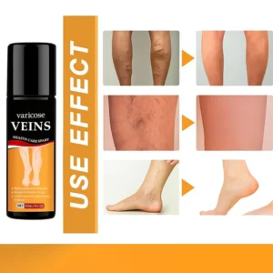 Turmeric Varicose Veins Relief Spray