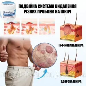 Oveallgo GentX Relief Natural cream HPV, warts, and eczema