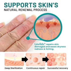 Lovilds® Probiotic + B 24-7 Moisture Eczema Relief Cream