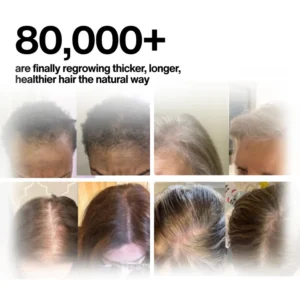 Veganic Hair Growth Oil