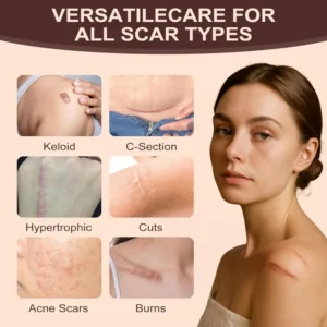 ReviaSkin™ Silicone Scar Stick