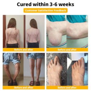 Relieflogix – Bee Venom-Infused Relief for Bones & Joints