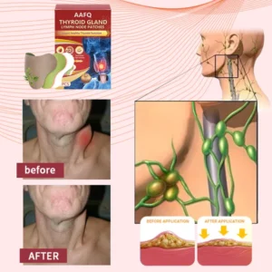 AAFQ™ Thyroid Lymph Node Patches
