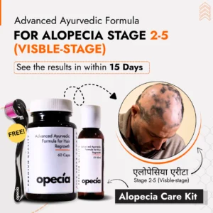 Advanced Formula For Alopecia Treatment