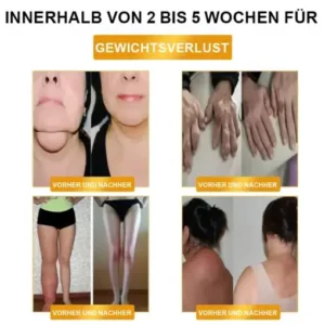 CZTICLE® Ultrasound Fat Reduction & Far Infrared Blood Sugar Balance