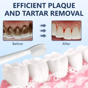 Ceoerty™ Bee Venom Stain Removal Treatment Toothpaste