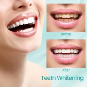 Ceoerty® RadiantSmile Oral Rinse