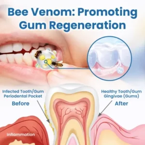 Ceoerty® RevitaDent Bee Venom Oral Treatment Powder