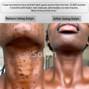 Solyn™ Cyperus Rotundus Skin Serum