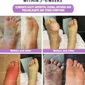 HONXI™ Turmeric and Emu Oil Anti-Inflammatory Slimming Foot Soak Pearls