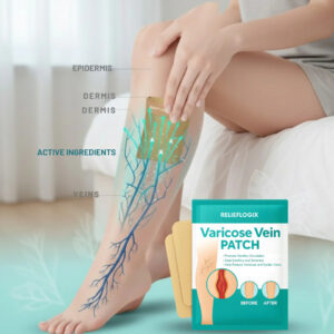 Reclaim Your Life From Unbearable Vein Pain