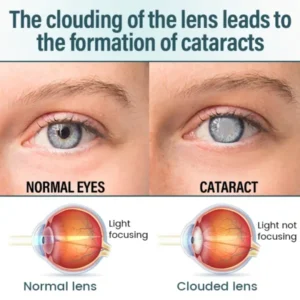 LOVILDS™ OptiFusion Nano Eye Drops Serum