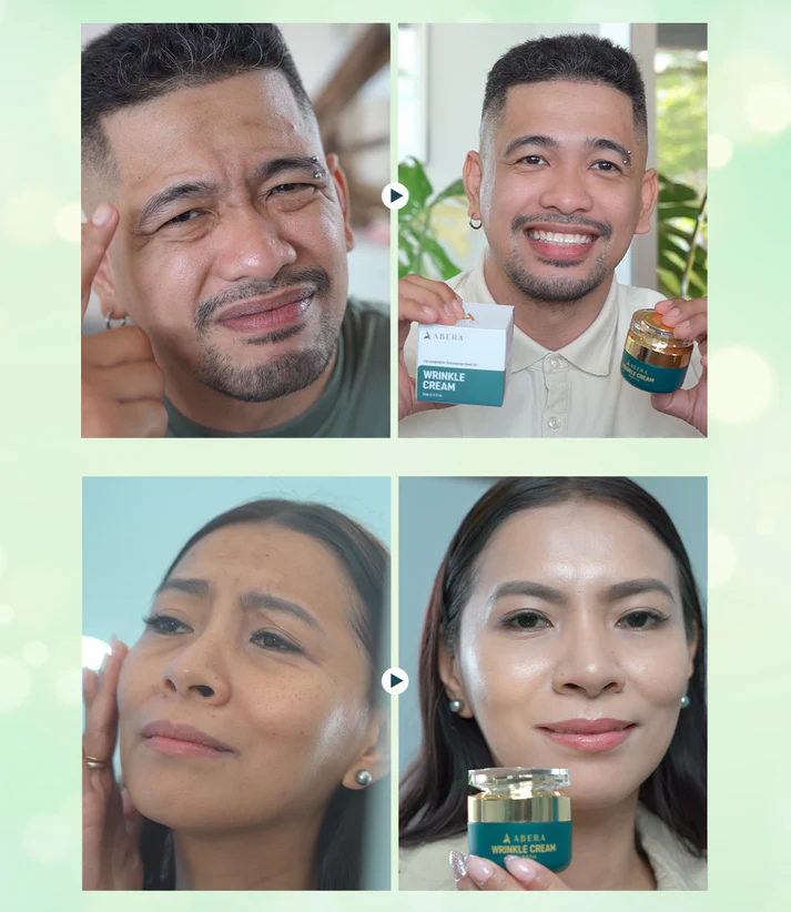 Abera Wrinkle Cream – Erases Wrinkles