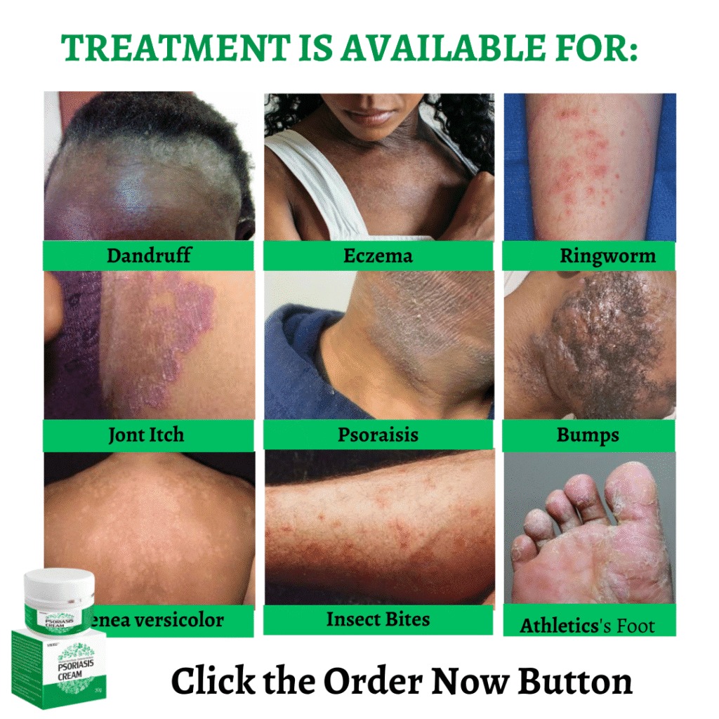 Natural Herbal Formula for Fast, Steroid-Free Relief