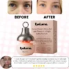 Eyeluma™ – The Korean Skincare Ritual That Awakens Your Eyes