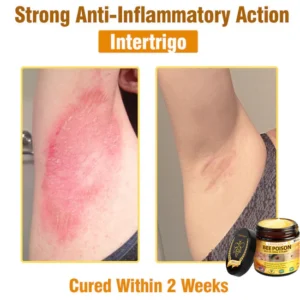 LOVILDS ALL IN ONE CREAM - BEE VENOM