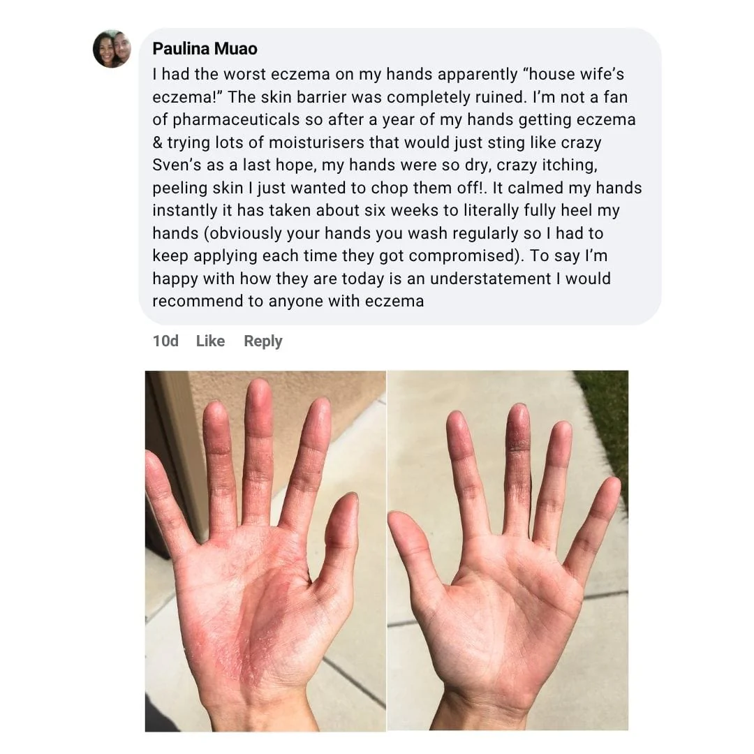 Miracle Manuka - Skin Repair Ointment 100g