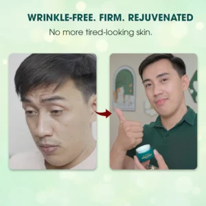 Abera Wrinkle Cream – Erases Wrinkles