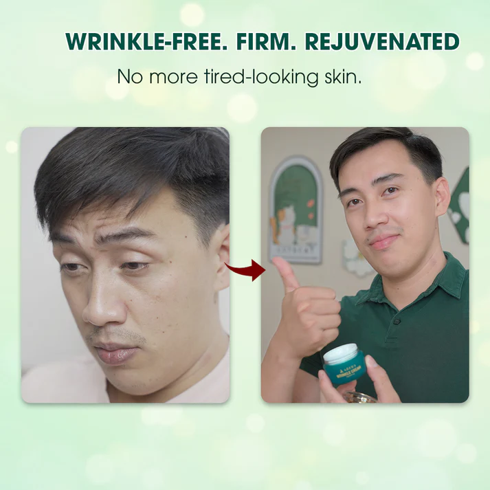 Abera Wrinkle Cream – Erases Wrinkles