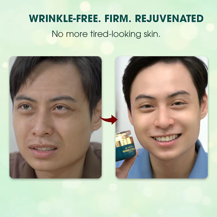 Abera Wrinkle Cream – Erases Wrinkles