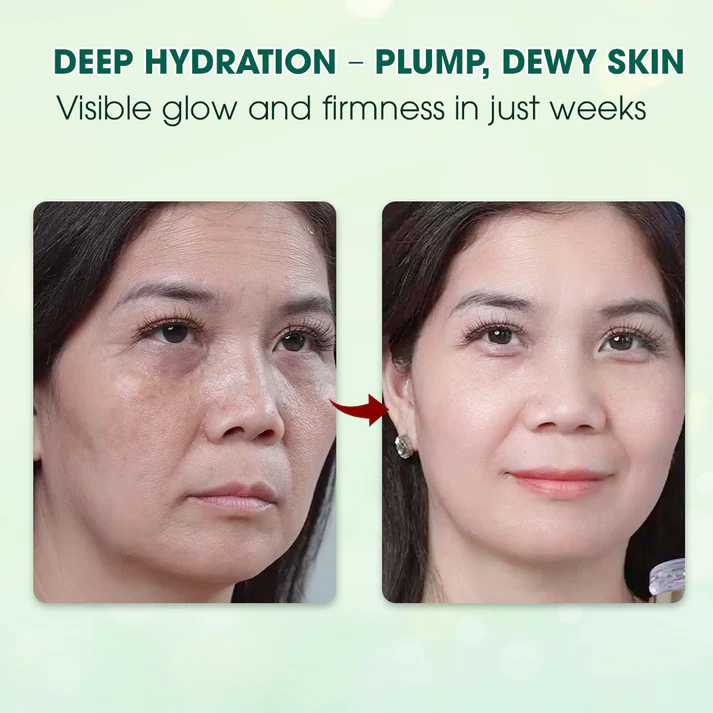 Abera Wrinkle Cream – Erases Wrinkles