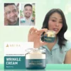 Abera Wrinkle Cream – Erases Wrinkles