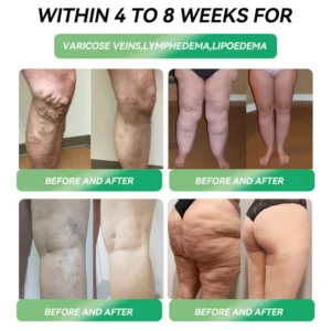 Croaie® Telportide Oral Solution