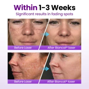 spot care serum with gentle probiotic formula