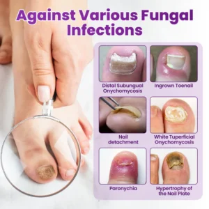 protective foot spray with easy mist application