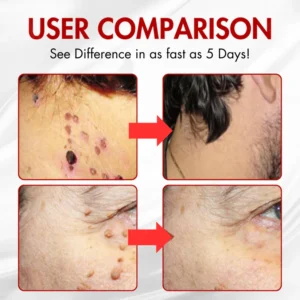 home skin spot care solution