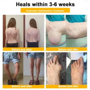 XRLXRL® Bee-Venom Pain-Relief Bone Healing Cream