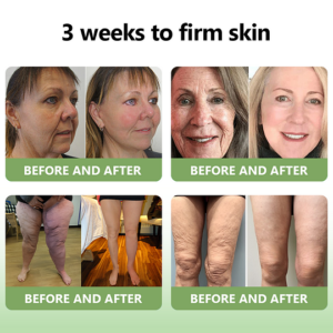 collagen based cream for skin tone support