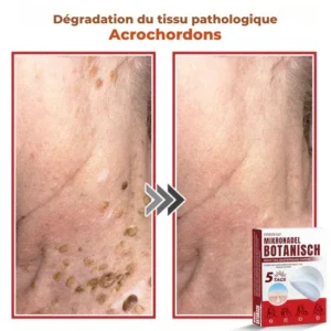 skin tag care patch