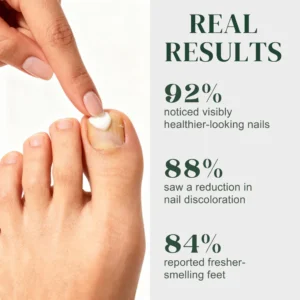 SYLK Nail Fungus Treatment Gel