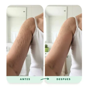 damaged skin care cream