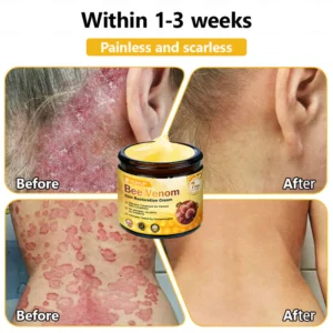 topical skin restoration cream for sensitive areas