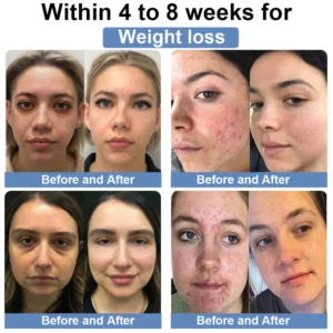 【Cvreoz® 𝐎𝐟𝐟𝐢𝐜𝐢𝐚𝐥 𝐁𝐫𝐚𝐧𝐝 𝐒𝐭𝐨𝐫𝐞】Women's Probiotic NMN Health Capsules