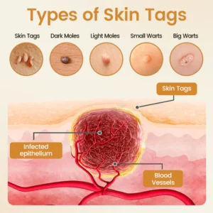 bee venom topical skin care