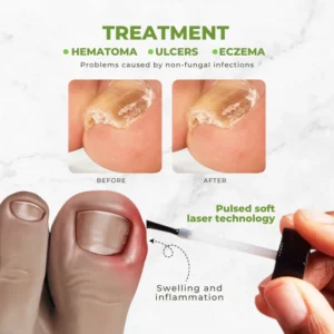 Bee Venom Infused Nail Repair & Strengthening Oil