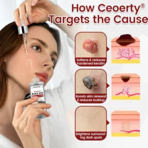 skin texture repair serum