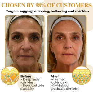 bee venom anti wrinkle care