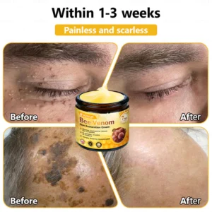 bee venom cream for skin comfort support