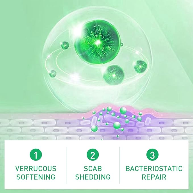 JAYSUING Effective Skin Corns Wart Remover Liquid Serum 1c1e21" face="Roboto, Arial, sans-serif">????কর্ন এবং কলাস হল ত্বকের পুরু, শক্ত স্তর যা ত্বক যখন ঘর্ষণ বা চাপ থেকে নিজেকে রক্ষা করার চেষ্টা করে তখন তৈরি হয়। এগুলি প্রায়শই পা এবং পায়ের আঙ্গুলে বা হাত এবং আঙ্গুলে তৈরি হয়। কর্ন ব্যথাজনক হতে পারে, বিশেষ করে যখন চাপ প্রয়োগ করা হয় এবং আকার এবং চেহারায় ভিন্নতা থাকতে পারে।????