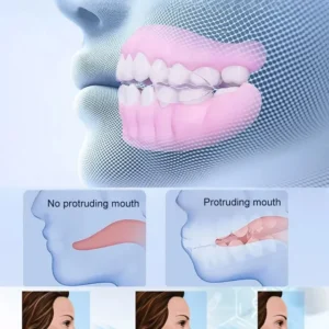 Yagoo Medical Full Denture