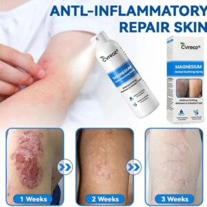 PsoriCalm Magnesium Soothing Spray