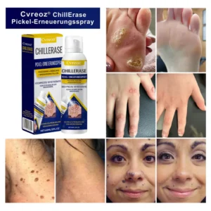 Cvreoz® ChillErase Blemish Renewal Spray